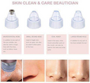 Pore Cleaning Device – 5-Level Suction Blackhead Remover & Pore Vacuum