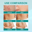South Moon Scar Spray – Skin Care Spray for the Appearance of Scars