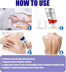 Warts Remover – Targeted Skin Treatment for Warts & Blemishes